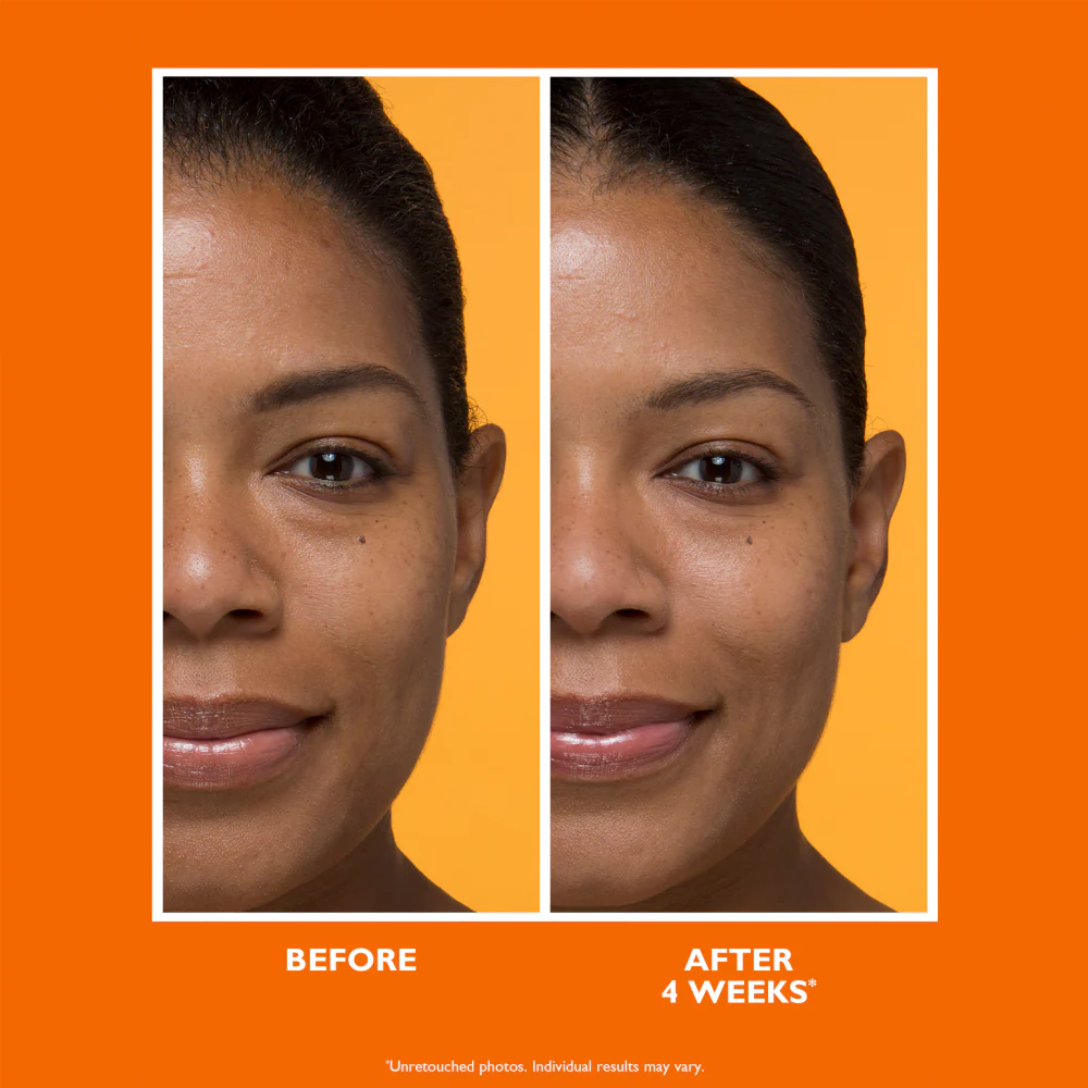 Peter Thomas Roth Potent-C Brightening Vitamin C Moisturiser 50ml - Image 4