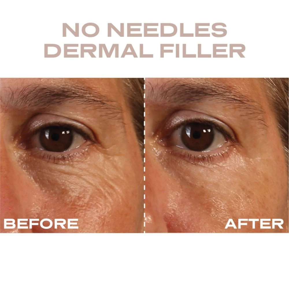 Plump It No Needles Derma Filler Pods Starter Kit 15 x 10ml - Image 3