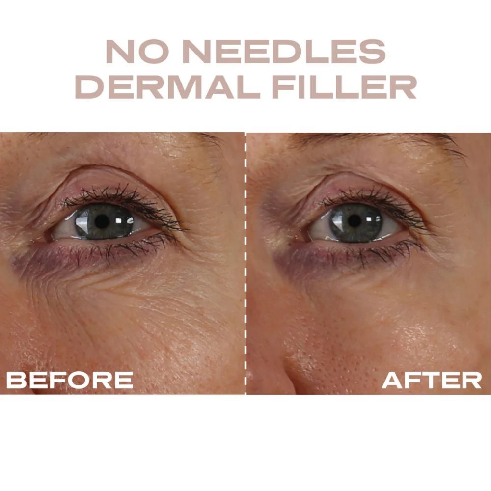 Plump It No Needles Derma Filler Pods Starter Kit 15 x 10ml - Image 7
