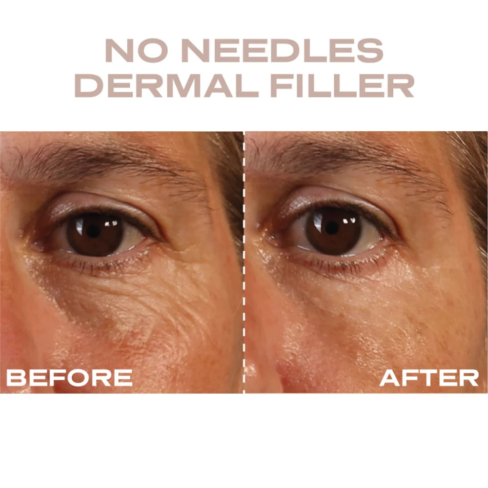 Plump It No Needles Derma Filler Pods Starter Kit 15 x 10ml - Image 8