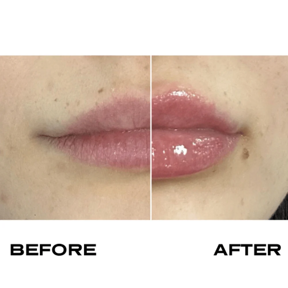 Plump It No Needles Lip Filler Kit Extreme Volume - Image 3