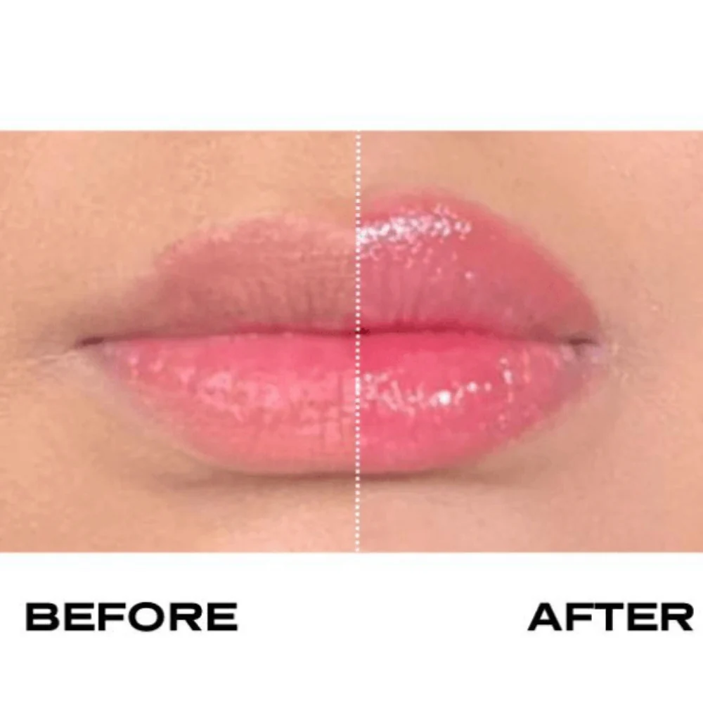 Plump It No Needles Lip Filler Kit Extreme Volume - Image 4