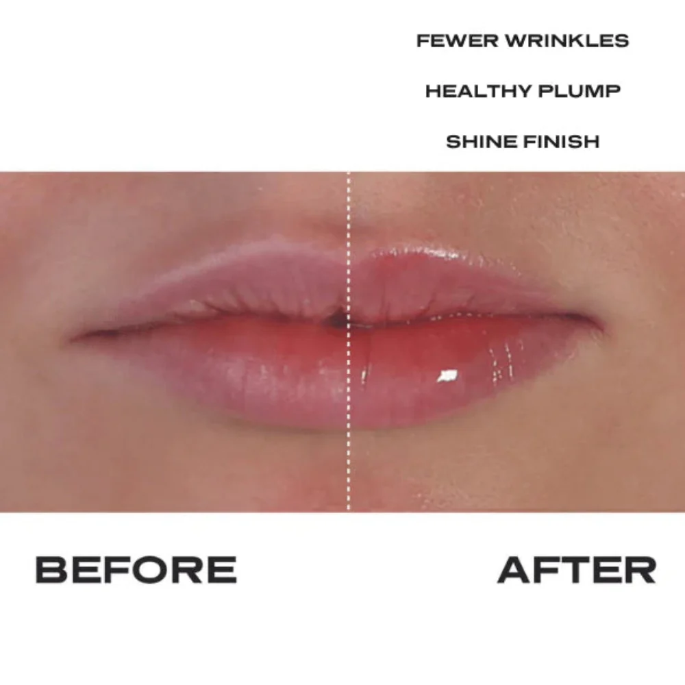 Plump It No Needles Lip Kit Builders - Image 3