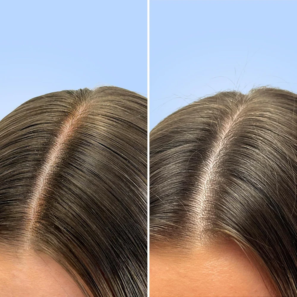 Q+A Clarifying Shampoo 250ml - Image 5