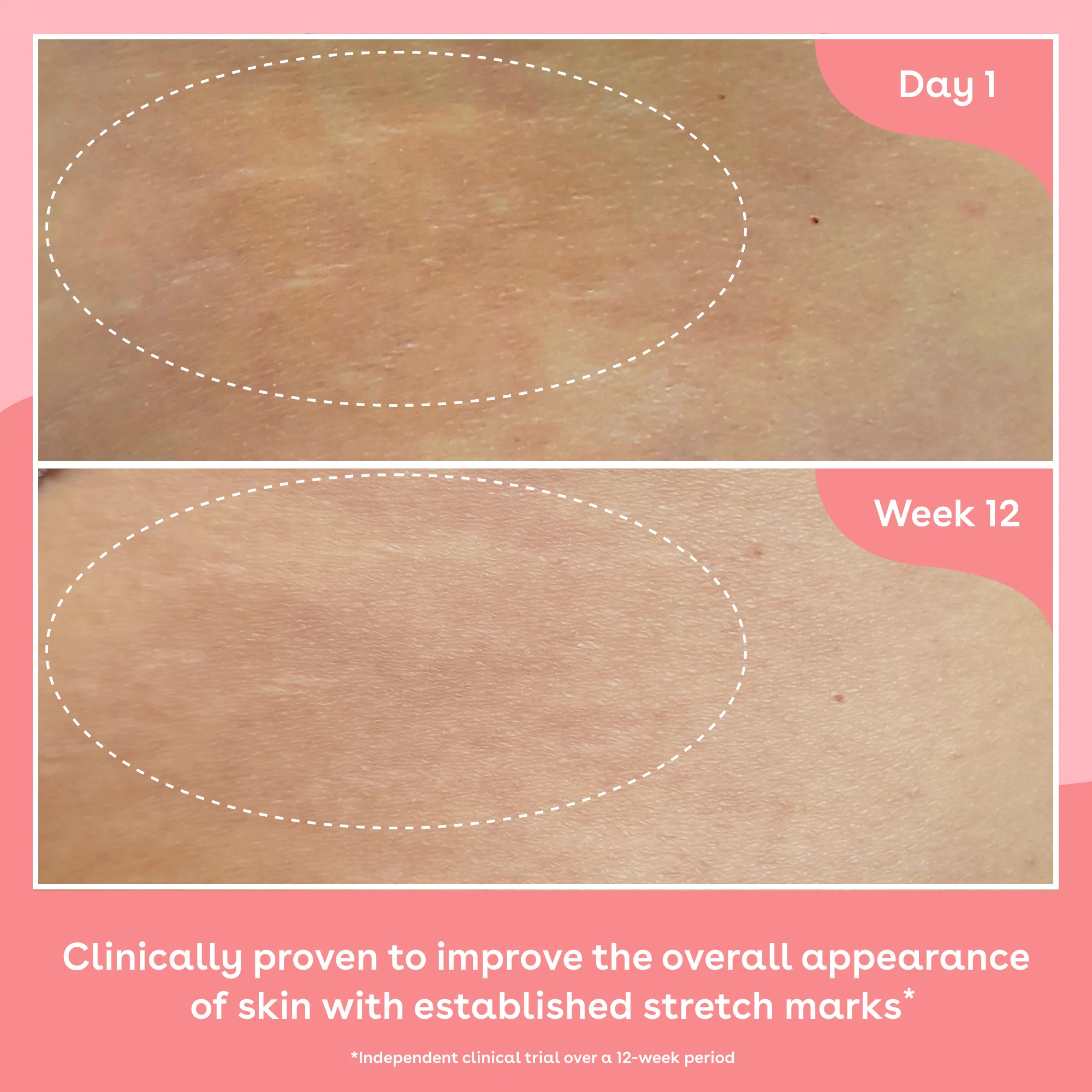 Q+A Collagen Firming Body Oil 150ml - Image 2
