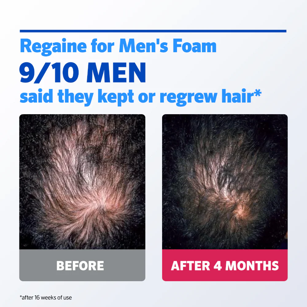 Regaine For Men 5% Extra Strength Regrowth Foam 1 Month Supply - Image 2