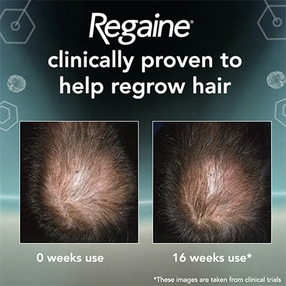 Regaine For Men 5% Extra Strength Regrowth Foam 6 Month Supply - Image 8