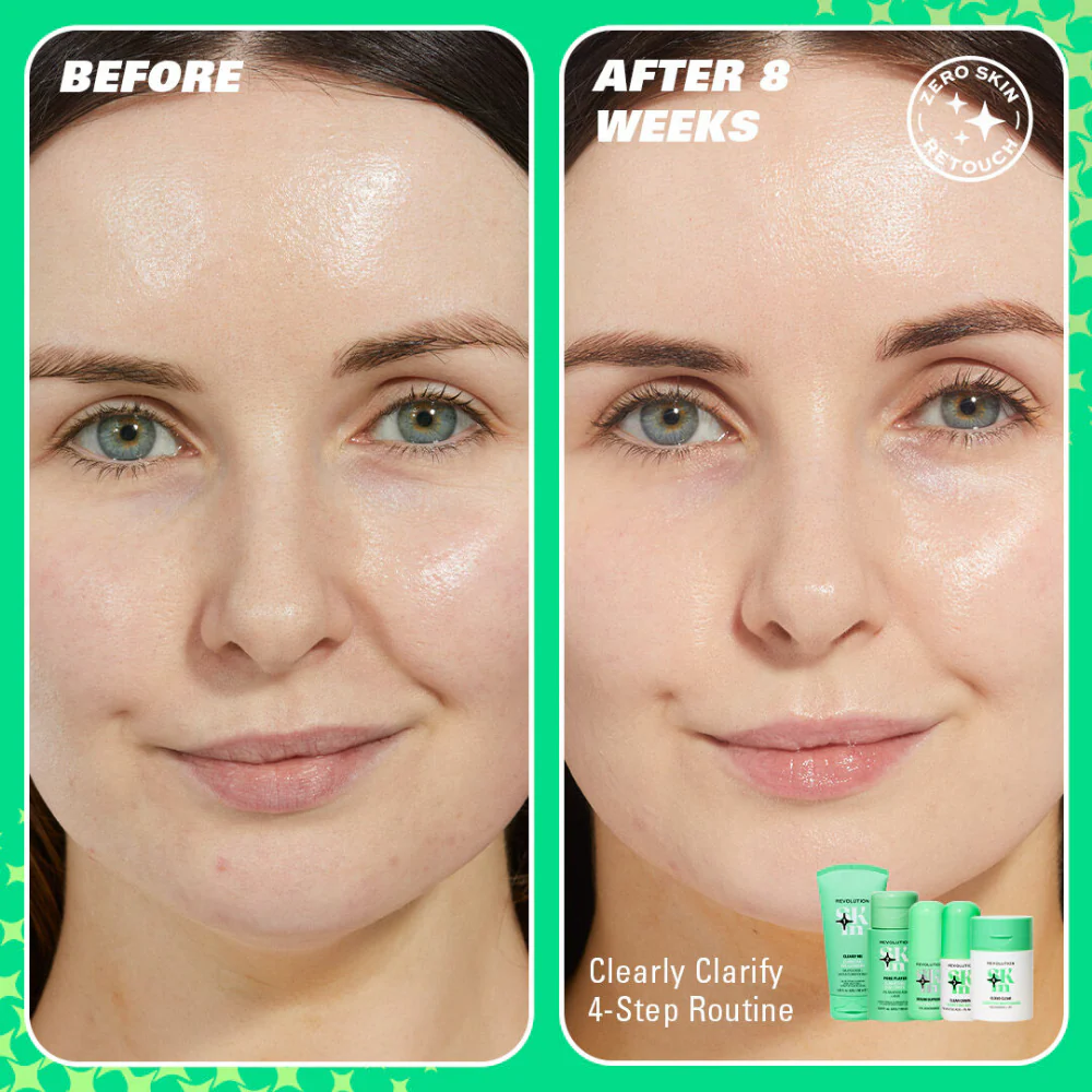 Revolution Skincare Clearly Clarify 4 Step Clarifying Routine - Image 3