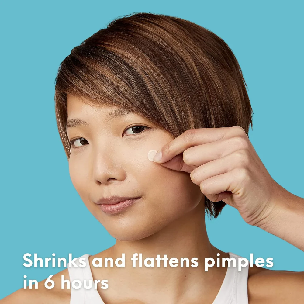 Skin Choice Breakout Classic Acne Spot Pimple Patches x75 - Image 9