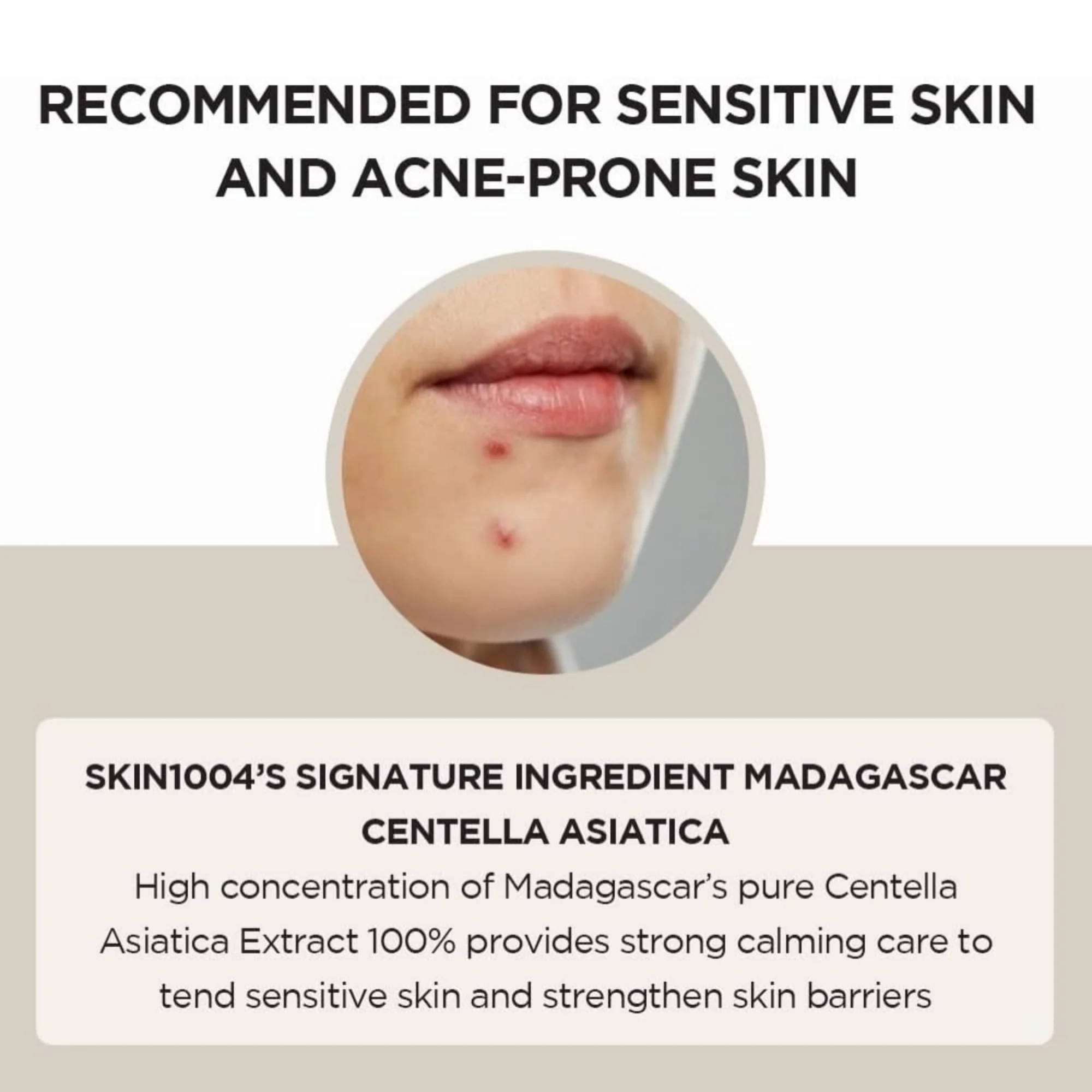 Skin1004 Madagascar Centella Ampoule 30ml - Image 3
