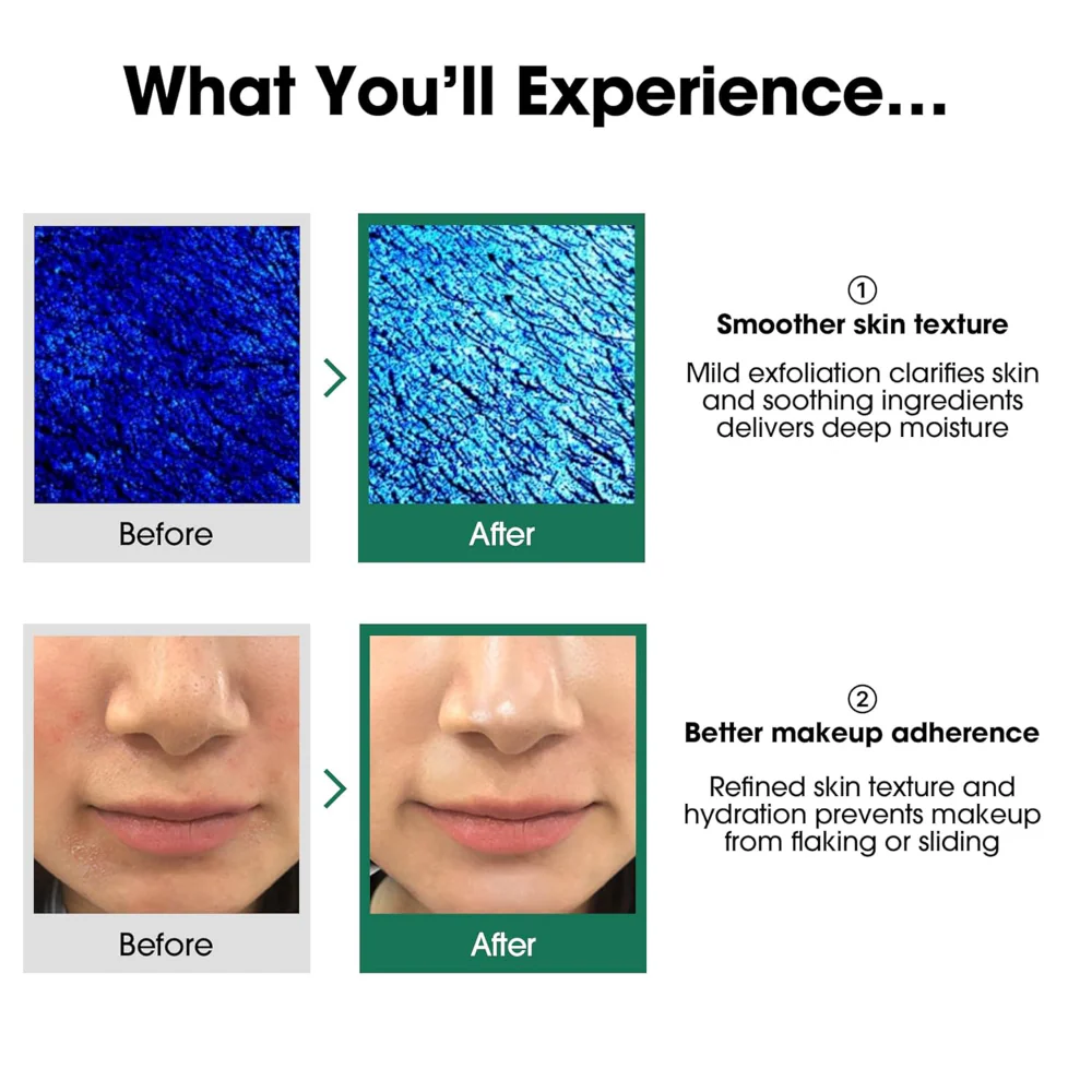 Some By Mi 30 Days AHA, BHA, PHA Miracle Toner 30ml - Image 4