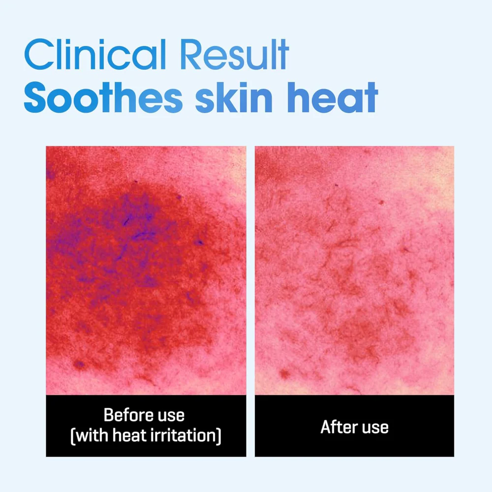 Some By Mi Beta Panthenol Repair Daily Sheet Masks x30 - Image 3