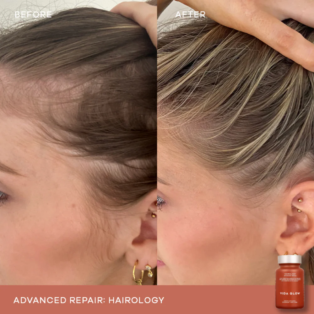 Vida Glow Hairology Advanced Repair Anagain Hair Growth Supplement 30 Capsules - Image 6