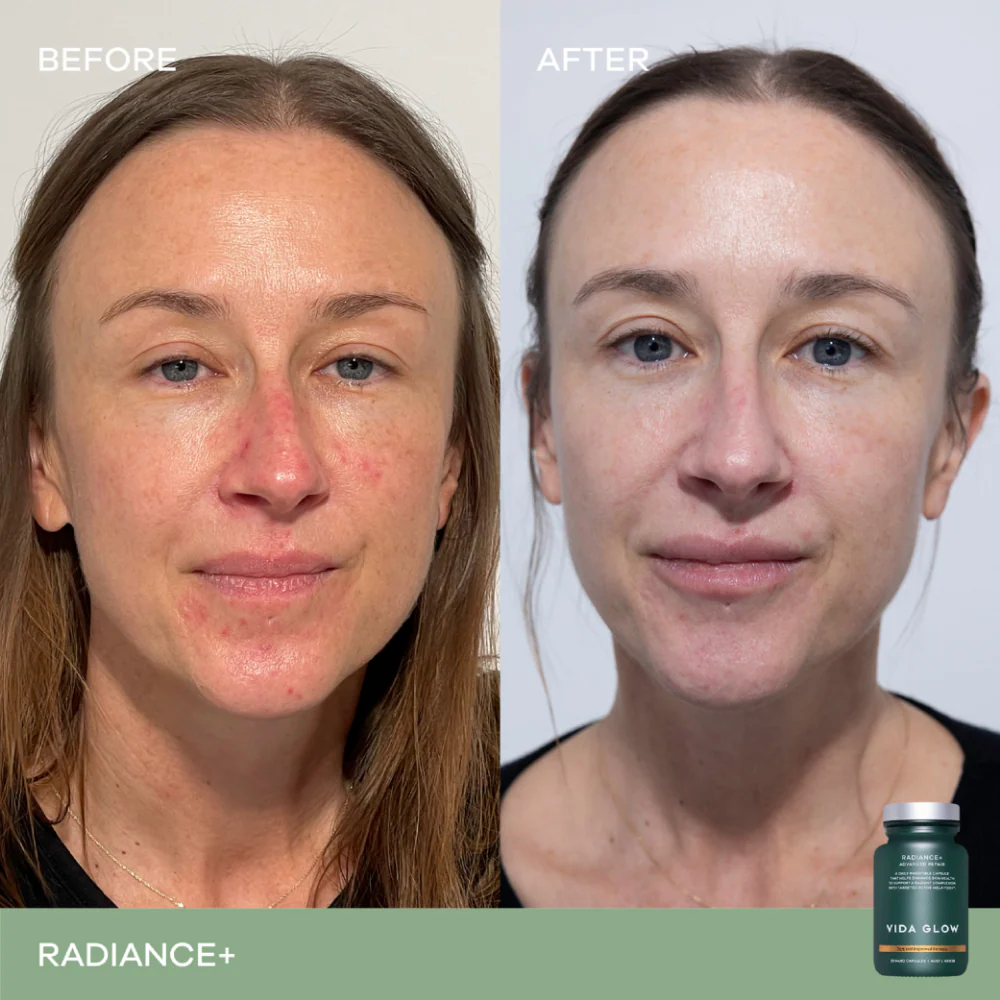 Vida Glow Radiance+ Advanced Repair Radiant Skin Supplement 30 Capsules - Image 6