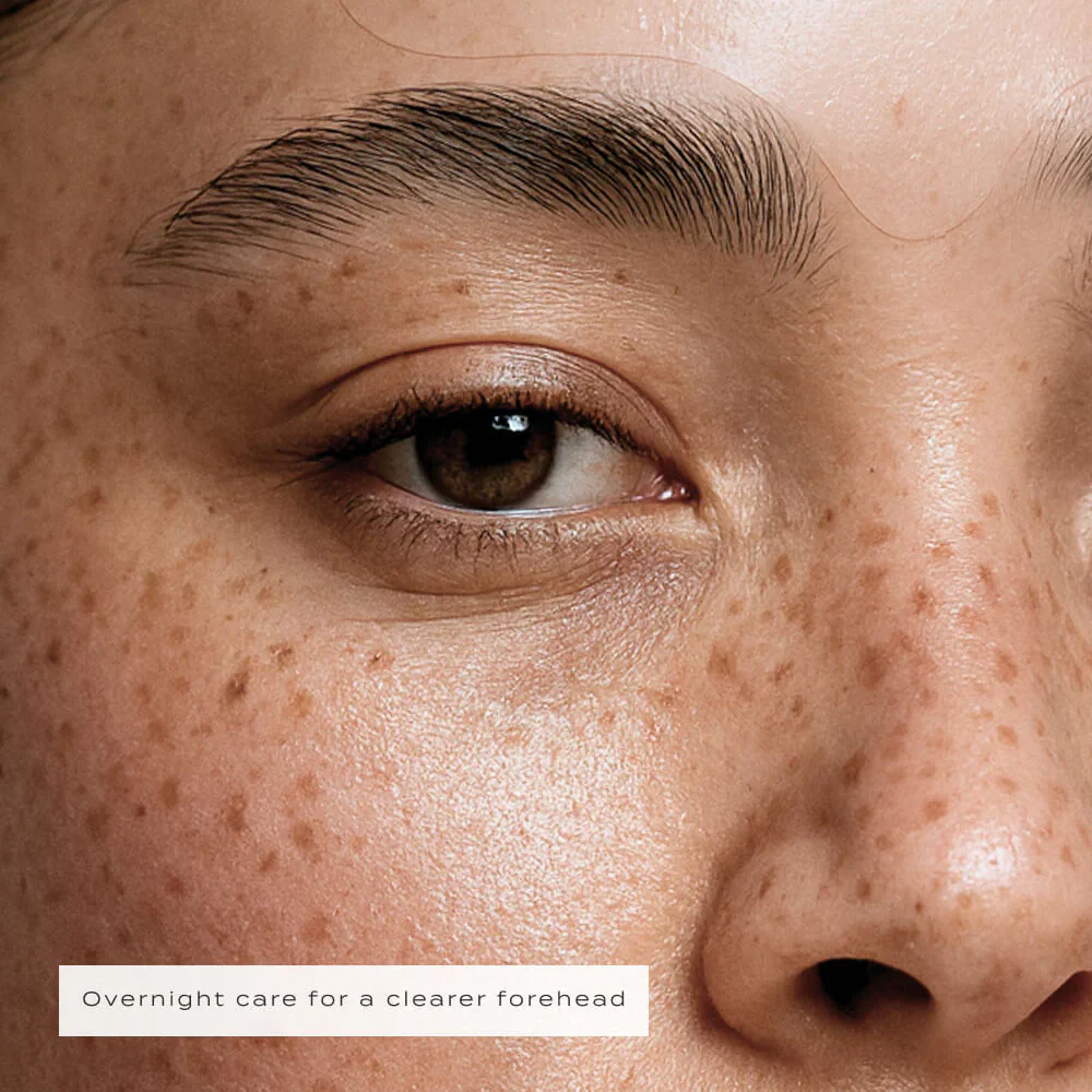 Vue Hydrocolloid Forehead Patches x5 - Image 6